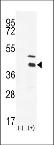 Western blot of DOK4 (arrow) using DOK4 Antibody. 293 cell lysates (2 ug/lane) either nontransfected (Lane 1) or transiently transfected with the DOK4 gene (Lane 2) (Origene Technologies).