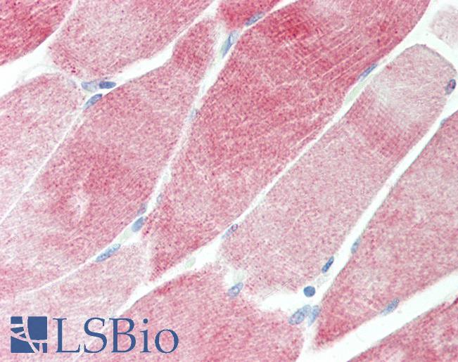 Anti-DOK4 antibody IHC staining of human skeletal muscle. Immunohistochemistry of formalin-fixed, paraffin-embedded tissue after heat-induced antigen retrieval. Antibody LS-B9973 concentration 10 ug/ml.