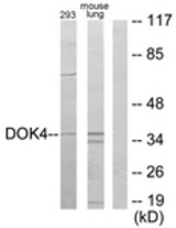 Western blot of extracts from 293/mouse lung cells, using DOK4 Antibody. The lane on the right is treated with the synthesized peptide.