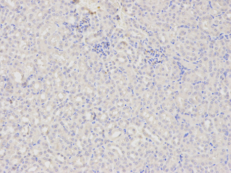 Immunohistochemistry of paraffin-embedded mouse kidney using DOK4 antibody at dilution of 1:200 (200x lens).