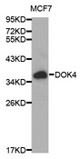 Western blot analysis of extracts of MCF7 cells, using DOK4 antibody.