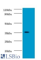 Western blot of Docking protein 5 antibody at 2 ug/ml with mouse kidney tissue Secondary Goat polyclonal to Rabbit IgG at 1:15000 dilution. Predicted band size: 35 KDa. Observed band size: 35 KDa.