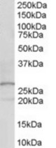 Antibody (0.1 ug/ml) staining of human kidney lysate (35 ug protein in RIPA buffer). Primary incubation was 1 hour. Detected by chemiluminescence.