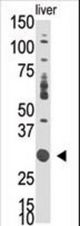 Western blot of anti-DOK5 antibody in mouse liver tissue lysate. DOK5(arrow) was detected using the purified Pab