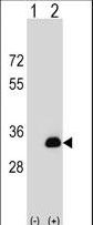 Western blot of DOK5 (arrow) using rabbit polyclonal DOK5 Antibody. 293 cell lysates (2 ug/lane) either nontransfected (Lane 1) or transiently transfected (Lane 2) with the DOK5 gene.