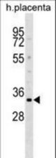 DOK5 Antibody western blot of human placenta tissue lysates (35 ug/lane). The DOK5 antibody detected the DOK5 protein (arrow).