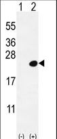 Western blot of DOK5 (arrow) using rabbit polyclonal DOK5 Antibody (L291). 293 cell lysates (2 ug/lane) either nontransfected (Lane 1) or transiently transfected (Lane 2) with the DOK5 gene.