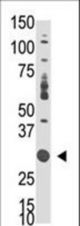The anti-DOK5 C-term antibody is used in Western blot to detect DOK5 in mouse liver tissue lysate.