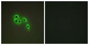 Immunofluorescence of A549 cells, using DOK6 Antibody. The picture on the right is treated with the synthesized peptide.