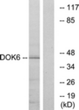 Western blot of extracts from COLO cells, using DOK6 Antibody. The lane on the right is treated with the synthesized peptide.