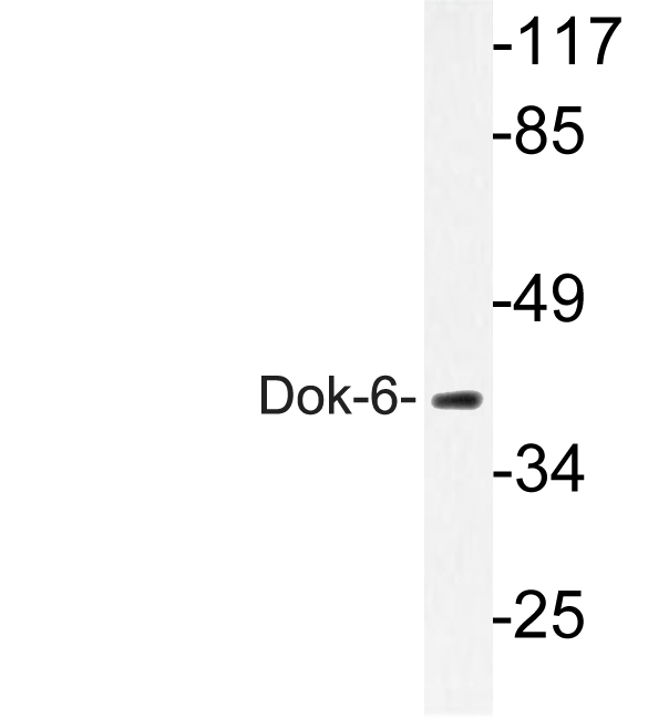 Western blot of Dok-6 (G130) pAb in extracts from COLO205 cells.
