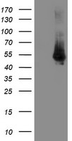 HEK293T cells were transfected with the pCMV6-ENTRY control (Left lane) or pCMV6-ENTRY DOK7 (Right lane) cDNA for 48 hrs and lysed. Equivalent amounts of cell lysates (5 ug per lane) were separated by SDS-PAGE and immunoblotted with anti-DOK7.