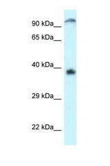 DOK7 antibody LS-C145325 Western blot of Jurkat Cell lysate. Antibody concentration 1 ug/ml.
