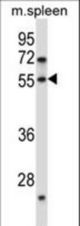 DOK7 Antibody western blot of mouse spleen tissue lysates (35 ug/lane). The DOK7 antibody detected the DOK7 protein (arrow).