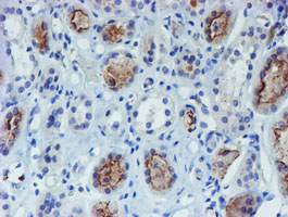 IHC of paraffin-embedded Human Kidney tissue using anti-DOK7 mouse monoclonal antibody.