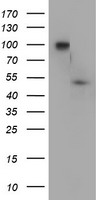 HEK293T cells were transfected with the pCMV6-ENTRY control (Left lane) or pCMV6-ENTRY DOK7 (Right lane) cDNA for 48 hrs and lysed. Equivalent amounts of cell lysates (5 ug per lane) were separated by SDS-PAGE and immunoblotted with anti-DOK7.