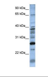 721_B cell lysate. Antibody concentration: 1.0 ug/ml. Gel concentration: 12%.