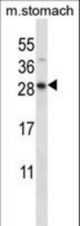 DOLPP1 Antibody western blot of mouse stomach tissue lysates (35 ug/lane). The DOLPP1 antibody detected the DOLPP1 protein (arrow).
