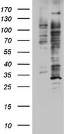 HEK293T cells were transfected with the pCMV6-ENTRY control (Left lane) or pCMV6-ENTRY DOT1L (Right lane) cDNA for 48 hrs and lysed. Equivalent amounts of cell lysates (5 ug per lane) were separated by SDS-PAGE and immunoblotted with anti-DOT1L.