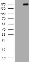 HEK293T cells were transfected with the pCMV6-ENTRY control (Left lane) or pCMV6-ENTRY DOT1L (Right lane) cDNA for 48 hrs and lysed. Equivalent amounts of cell lysates (5 ug per lane) were separated by SDS-PAGE and immunoblotted with anti-DOT1L.