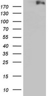 HEK293T cells were transfected with the pCMV6-ENTRY control (Left lane) or pCMV6-ENTRY DOT1L (Right lane) cDNA for 48 hrs and lysed. Equivalent amounts of cell lysates (5 ug per lane) were separated by SDS-PAGE and immunoblotted with anti-DOT1L.