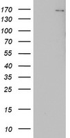 HEK293T cells were transfected with the pCMV6-ENTRY control (Left lane) or pCMV6-ENTRY DOT1L (Right lane) cDNA for 48 hrs and lysed. Equivalent amounts of cell lysates (5 ug per lane) were separated by SDS-PAGE and immunoblotted with anti-DOT1L.