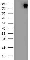 HEK293T cells were transfected with the pCMV6-ENTRY control (Left lane) or pCMV6-ENTRY DOT1L (Right lane) cDNA for 48 hrs and lysed. Equivalent amounts of cell lysates (5 ug per lane) were separated by SDS-PAGE and immunoblotted with anti-DOT1L.