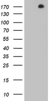 HEK293T cells were transfected with the pCMV6-ENTRY control (Left lane) or pCMV6-ENTRY DOT1L (Right lane) cDNA for 48 hrs and lysed. Equivalent amounts of cell lysates (5 ug per lane) were separated by SDS-PAGE and immunoblotted with anti-DOT1L.