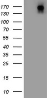 HEK293T cells were transfected with the pCMV6-ENTRY control (Left lane) or pCMV6-ENTRY DOT1L (Right lane) cDNA for 48 hrs and lysed. Equivalent amounts of cell lysates (5 ug per lane) were separated by SDS-PAGE and immunoblotted with anti-DOT1L.