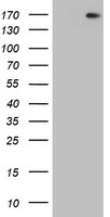 HEK293T cells were transfected with the pCMV6-ENTRY control (Left lane) or pCMV6-ENTRY DOT1L (Right lane) cDNA for 48 hrs and lysed. Equivalent amounts of cell lysates (5 ug per lane) were separated by SDS-PAGE and immunoblotted with anti-DOT1L.