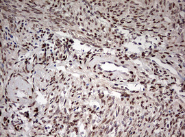 IHC of paraffin-embedded Human endometrium tissue using anti-DOT1L mouse monoclonal antibody. (Heat-induced epitope retrieval by 10mM citric buffer, pH6.0, 120°C for 3min).