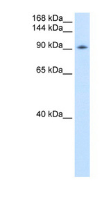 DDX54 antibody LS-C40304 Western blot of Transfected 293T cell lysate.