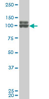 DDX54 monoclonal antibody (M02), clone 2E4 Western blot of DDX54 expression in A-431.