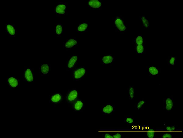 Immunofluorescence of monoclonal antibody to DDX54 on HeLa cell. [antibody concentration 10 ug/ml]
