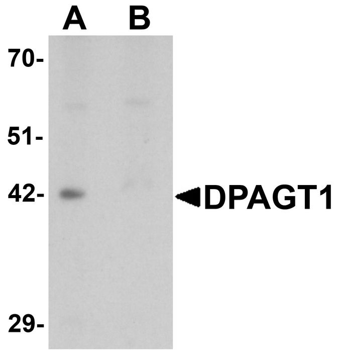 Western blot analysis of DPAGT1 in mouse kidney tissue lysate with DPAGT1 antibody at 1 ug/ml in (A) the absence and (B) the presence of blocking peptide.