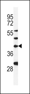 Western blot of DPAGT1 Antibody in MDA-MB231 cell line lysates (35 ug/lane). DPAGT1 (arrow) was detected using the purified antibody.
