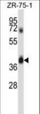 DPAGT1 Antibody western blot of ZR-75-1 cell line lysates (35 ug/lane). The DPAGT1 antibody detected the DPAGT1 protein (arrow).