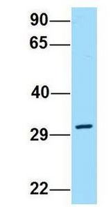 DPAGT2 / DPAGT1 antibody Western Blot of Human MCF7 lysate. Antibody Dilution: 1.0ug/ml. DPAGT1 is supported by BioGPS gene expression data to be expressed in MCF7. Antibody dilution: 1 ug/ml.