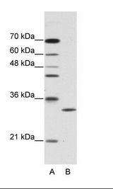 A: Marker, B: HepG2 Cell Lysate