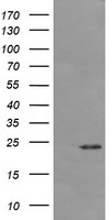 HEK293T cells were transfected with the pCMV6-ENTRY control (Left lane) or pCMV6-ENTRY DPCD (Right lane) cDNA for 48 hrs and lysed. Equivalent amounts of cell lysates (5 ug per lane) were separated by SDS-PAGE and immunoblotted with anti-DPCD.