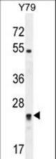 RP11-529I10.4 Antibody western blot of Y79 cell line lysates (35 ug/lane). The RP11 antibody detected the RP11 protein (arrow).