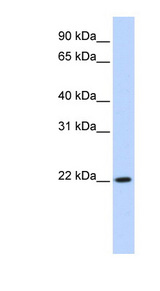DPCD antibody LS-C102604 Western blot of HeLa lysate.