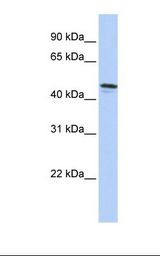 HepG2 cell lysate. Antibody concentration: 1.0 ug/ml. Gel concentration: 12%.