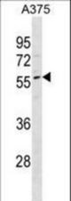 DPCR1 Antibody western blot of A375 cell line lysates (35 ug/lane). The DPCR1 antibody detected the DPCR1 protein (arrow).