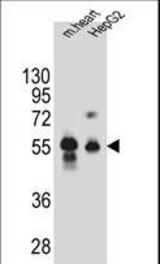 DPEP3 Antibody western blot of mouse heart tissue and HepG2 cell line lysates (35 ug/lane). The DPEP3 antibody detected the DPEP3 protein (arrow).