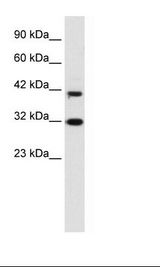 HepG2 Cell Lysate