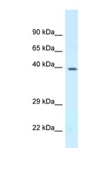 DPF3 antibody LS-C145764 Western blot of Mouse Spleen lysate. Antibody concentration 1 ug/ml.