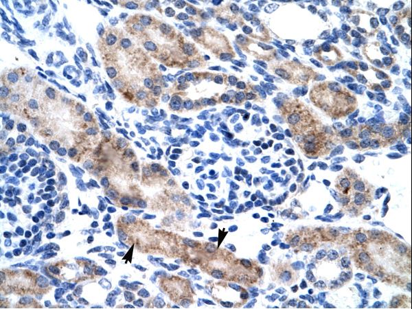 CLIC1 antibody LS-C30646 was used in IHC to stain formalin-fixed, paraffin-embedded human kidney.