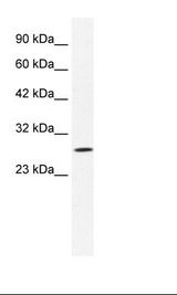 Jurkat Cell Lysate