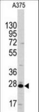 Western blot of anti-CLIC1 Antibody in A375 cell line lysates (35 ug/lane). CLIC1(arrow) was detected using the purified antibody.